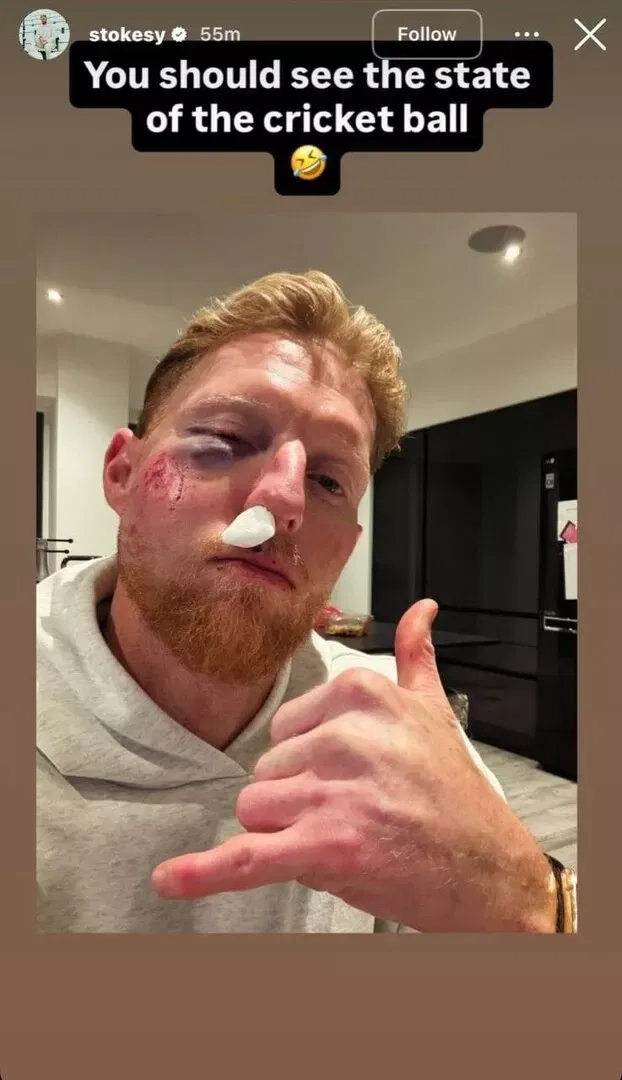 Ben Stokes injury